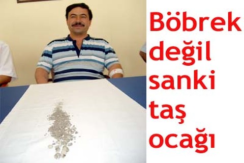 Böbrek değil sanki taş ocağı