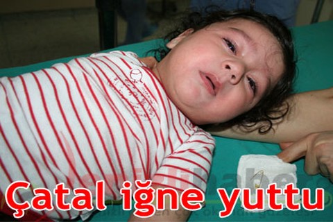 Çatal iğne yuttu