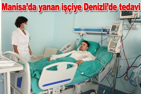 Manisa’da yanan işçiye Denizli’de tedavi