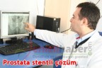 Prostata stentli çözüm