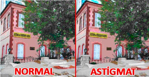astigmat