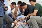 Yaralı vatandaşa gazeteciler yardım etti