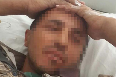Cinayet zanlısı, domuz sanılarak av tüfeğiyle vurulunca, yaralı yakalandı