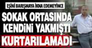 Sarayköy’de eşini barışmaya ikna edemeyince kendini yakan adam hayatını kaybetti