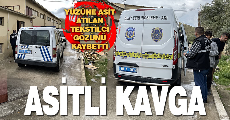 Denizli’de yüzüne asit türü sıvı atılan kişi bir gözünü kaybetti