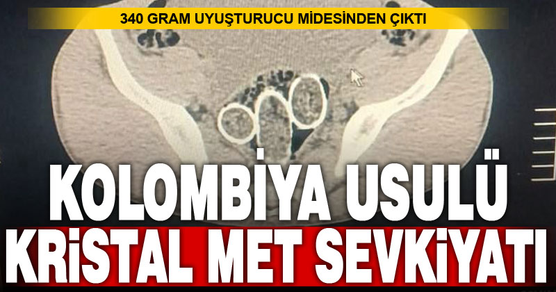 İki şüphelinin midesinden 340 gram kristal met çıktı