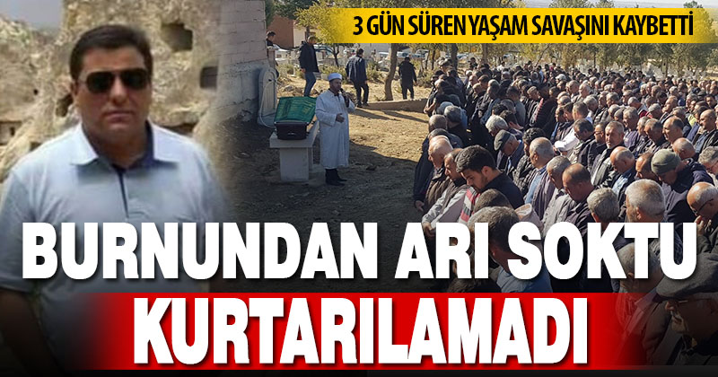 Burnundan arı soktu, hayatını kaybetti