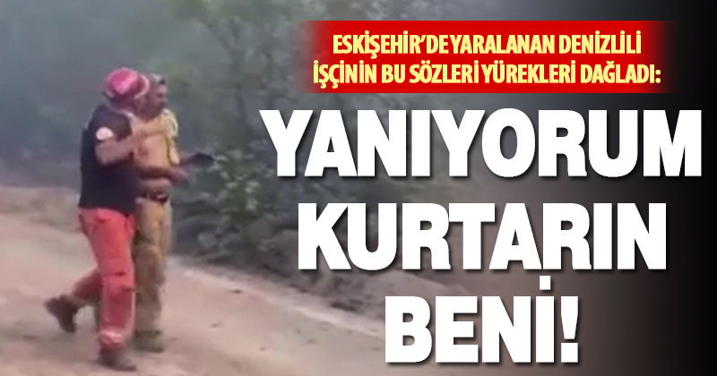 Eskişehir’deki yangında yaralanan Denizlili işçinin görüntüleri ortaya çıktı: Yanıyorum, kurtarın beni