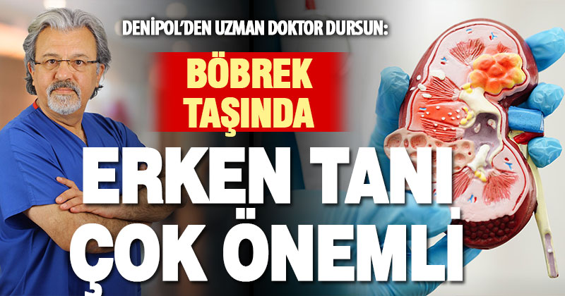 Uzman Doktor Dursun: Erken tanı taş oluşumunun önüne geçilebilir