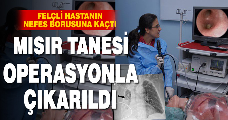 NEFES BORUSUNA MISIR TANESİ KAÇTI