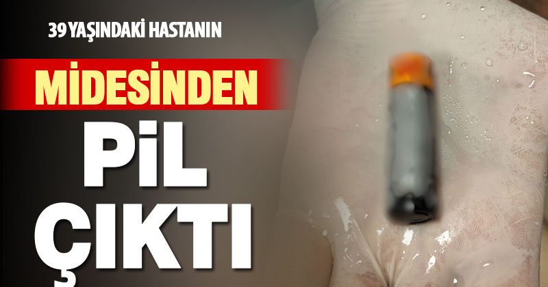 Yuttuğu pil midesinden çıkartılan 39 yaşındaki hasta sağlığına kavuştu